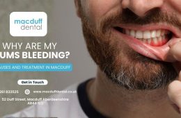 Why Are My Gums Bleeding? Causes and Treatment in Macduff