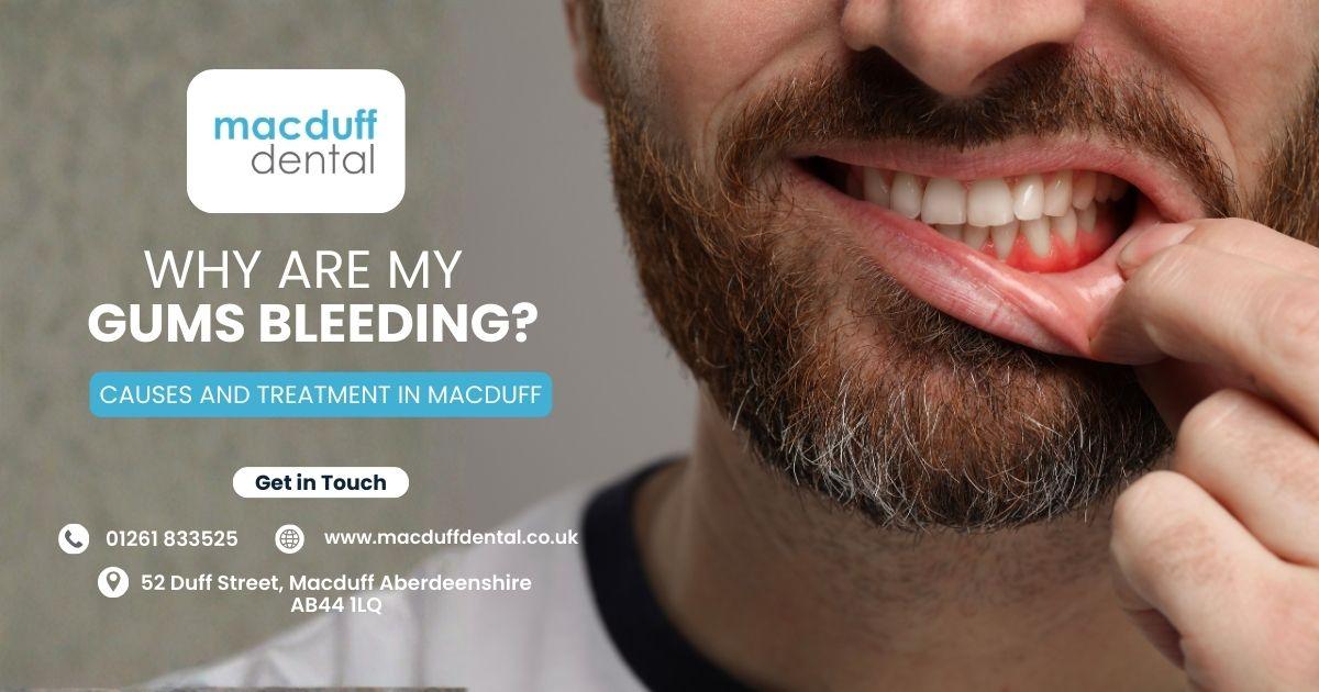 My Gums Bleeding