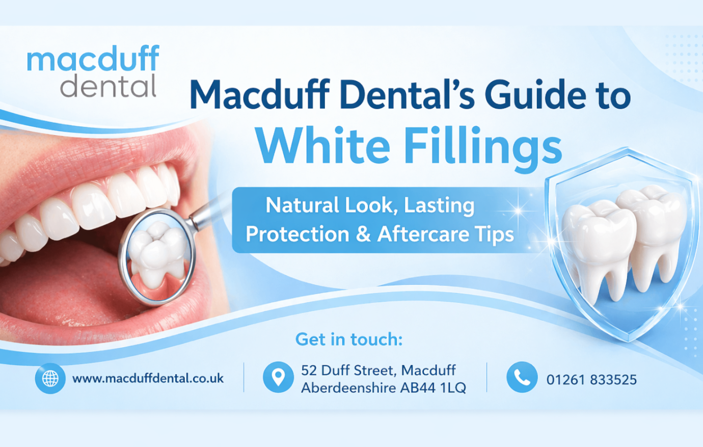 White Dental Fillings