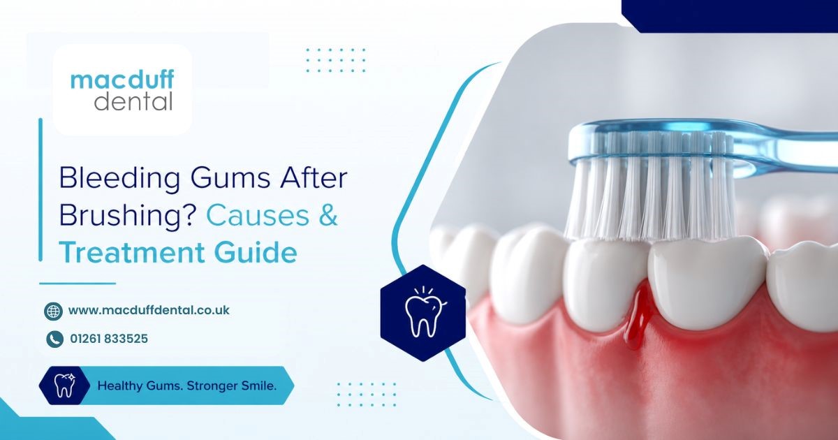 Gums Bleeding After Brushing