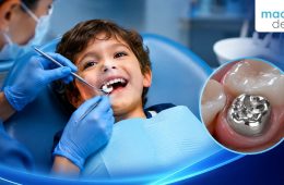 Stainless Steel Crown for a Child: What Parents Should Know